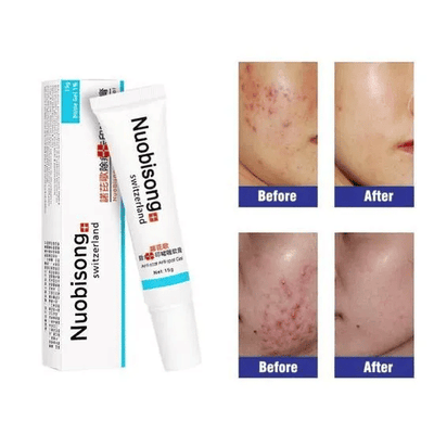 Nuobisong Skin Restoration Scar Gel Dark Spots Stretch Marks 15g