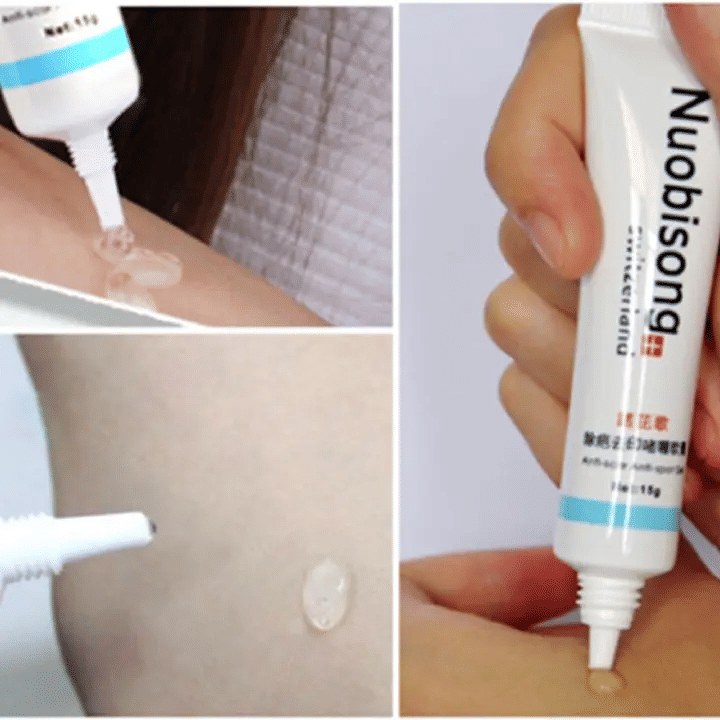 Nuobisong Skin Restoration Scar Gel Dark Spots Stretch Marks 15g