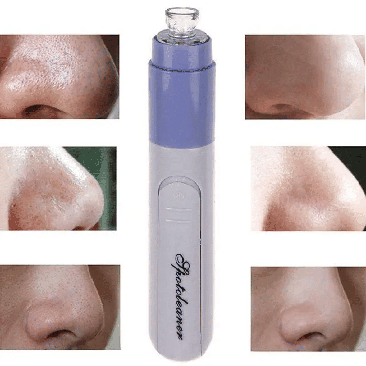 Electric Vacuum Facial Pore Cleanser Spot Cleaner Blackhead Acne Suction Remover