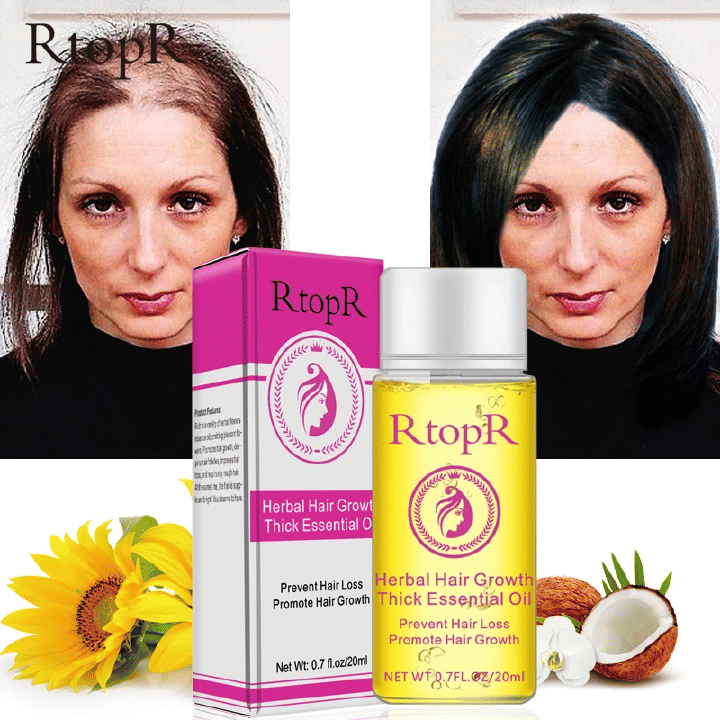 RtopR Hair Growth Essential Oil 20ml Herbal Fast Longer Thick Essence Professional Anti-Hair Loss