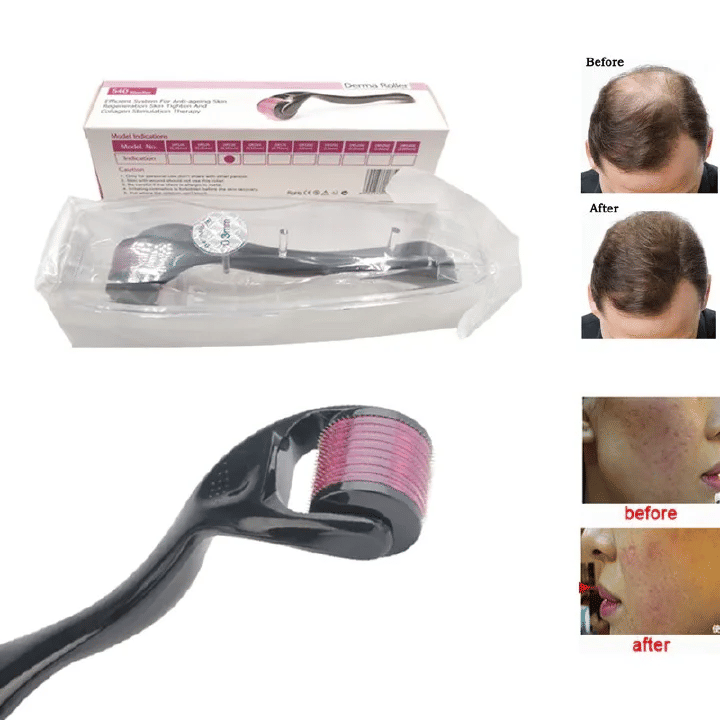 540 Needles Derma Micro Needle Titanium Roller for Anti Hair Loss Hair Regrowth