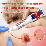Genital Warts Remover Antibacterial Treatment Cream 20g