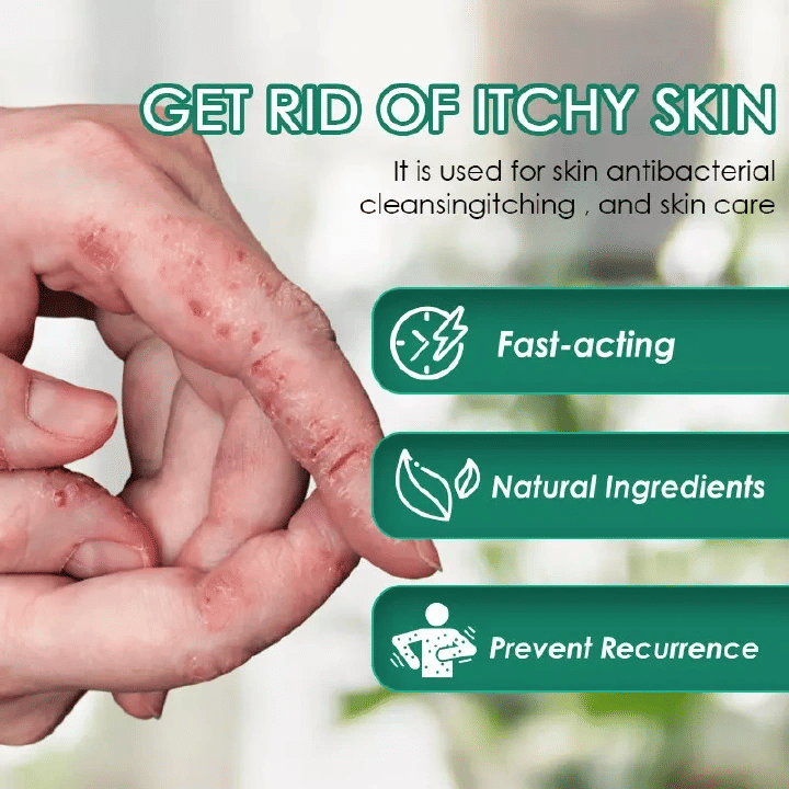 Kilimall Psoriasis Cream Dermatitis Shingles Bites Rash Relief Eczema Pruritus Scalp Antibacterial Ointment Herbal Medical Plaster Skin Care
