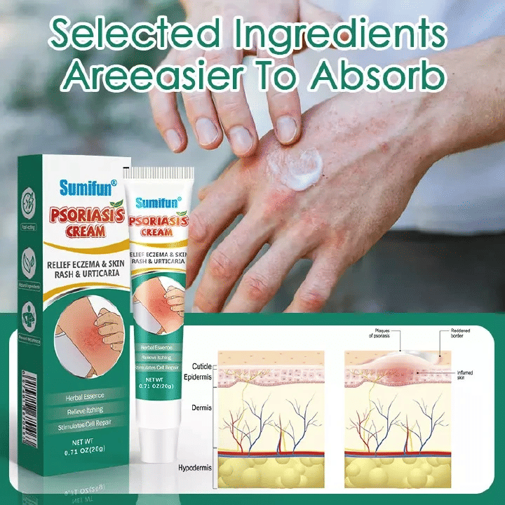 Kilimall Psoriasis Cream Dermatitis Shingles Bites Rash Relief Eczema Pruritus Scalp Antibacterial Ointment Herbal Medical Plaster Skin Care