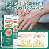 Kilimall Psoriasis Cream Dermatitis Shingles Bites Rash Relief Eczema Pruritus Scalp Antibacterial Ointment Herbal Medical Plaster Skin Care