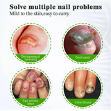KanyeHB Nail Fungus Treatment Cream Onychomycosis Paronychia Removal Anti Infection Toe Foot Care Ointment 20g