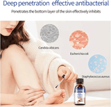 Healmusz Nail Fungus Treatment Essence Removes Onychomycosis Nourishes Brightening Hands Feet Skincare