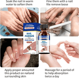 Healmusz Nail Fungus Treatment Essence Removes Onychomycosis Nourishes Brightening Hands Feet Skincare