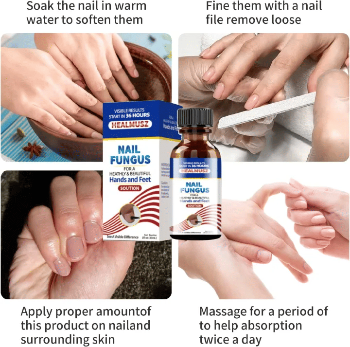 Healmusz Nail Fungus Treatment Essence Removes Onychomycosis Nourishes Brightening Hands Feet Skincare