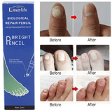 Biological Repair Pencil Nail Fungus Treatment Cuticle Oil Anti-Infection Foot Care
