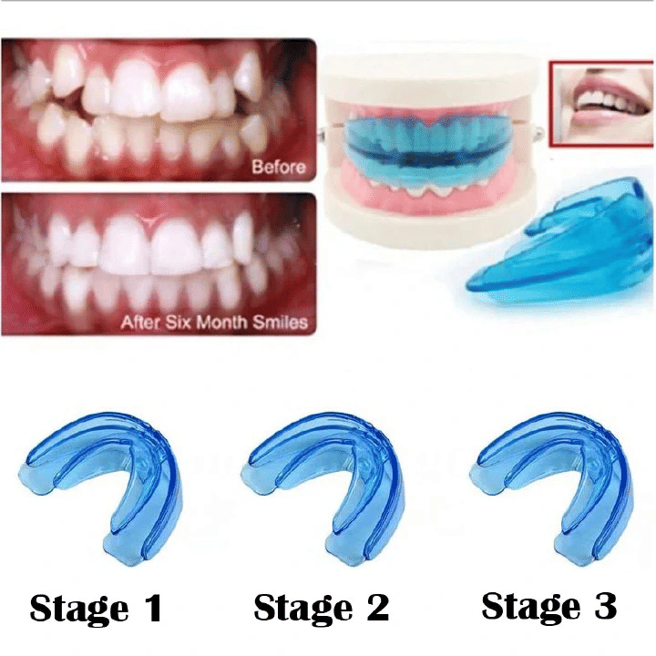 Kilimall Teeth Alignment Braces Orthodontic Dental Straightener Trainer Retainer Mouthguard Tooth Tray