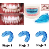 Kilimall Teeth Alignment Braces Orthodontic Dental Straightener Trainer Mouthguard Tooth Tray