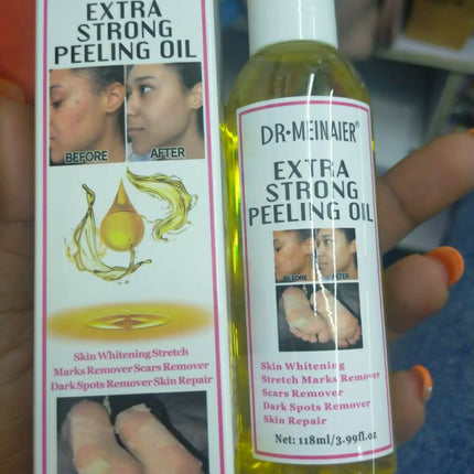 Extra Strong Peeling Oil Elbows Knees Hands Even Complexion