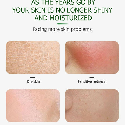 Aichun Beauty Hemp Anti Acne Face Repair Serum
