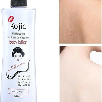 Kojic Skin Lightening Body Lotion