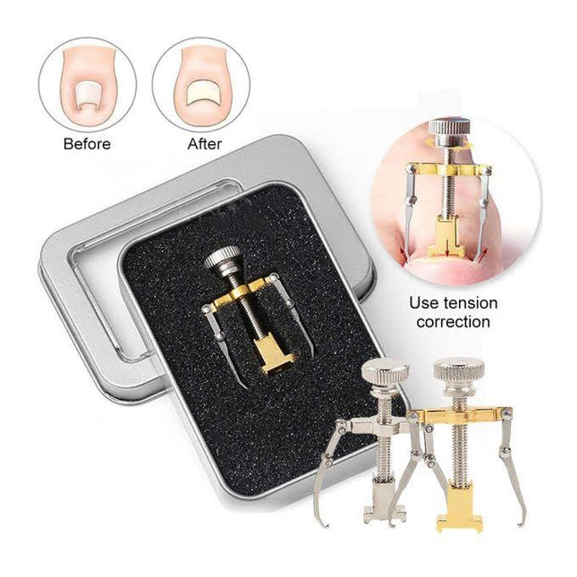 Medically Approved Nail Aligner Ingrown Toenail Corrector Lifter Nail Correction Kit Toe Clamp Clip