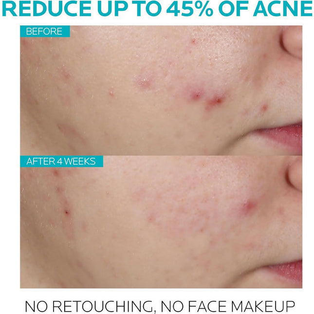 La Roche Posay Effaclar Serum